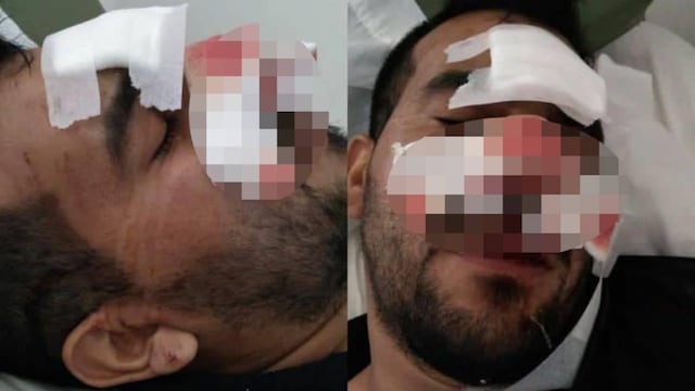 El muchacho es de Alvear pero lo hospitalizaron en la ciudad donde se registró el ataque.