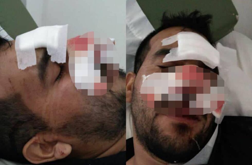 Fue a bailar a Arroyo Seco y terminó internado por una golpiza en el boliche