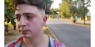 Marcos, víctima de abuso policial