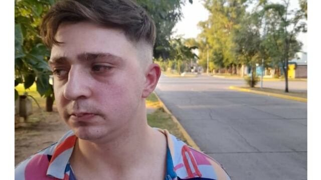 Marcos, víctima de abuso policial