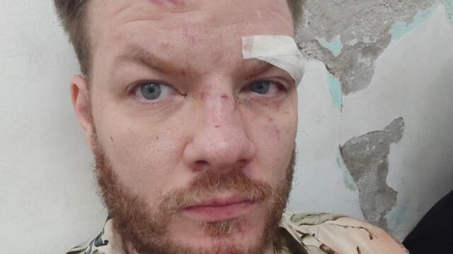 Federico Piccioni Aimar, el periodista de La Voz golpeado a las afueras de Zebra, en Villa Carlos Paz.