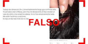 Esta imagen que muestra una supuesta herida provocada por Sergio Massa en LN+ es de 2020 y no está relacionada con el candidato.