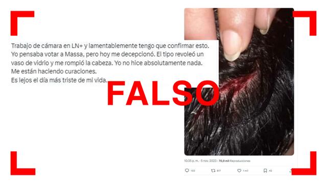 Esta imagen que muestra una supuesta herida provocada por Sergio Massa en LN+ es de 2020 y no está relacionada con el candidato.