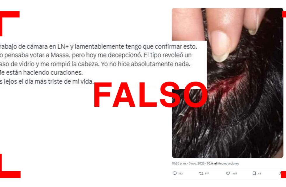 Es falso que Sergio Massa haya provocado un corte en la cabeza de un camarógrafo tras la entrevista en LN+