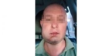 Así quedó el rostro de Carlos Galíndez luego de ser atacado.