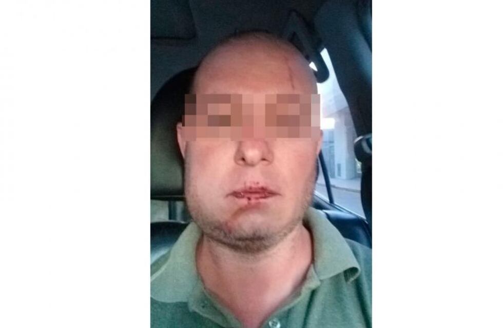 Operaron al hombre golpeado por policías: placa de titanio y pérdida de la sensibilidad