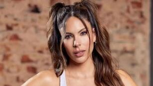 Barby Franco mostró un polémico tratamiento estético y sus seguidores le recordaron a Silvina Luna