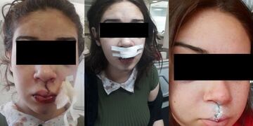 Denuncia que un policía de Córdoba le pegó en la cara con la culata de su arma.