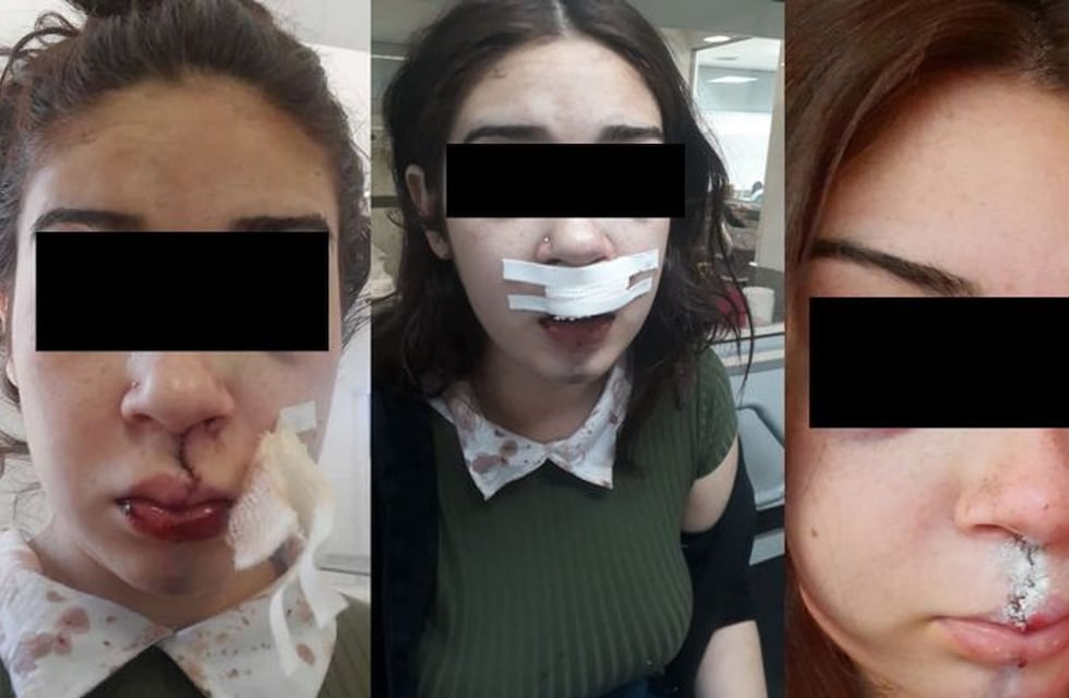 Violencia en Córdoba: denuncian que fueron salvajemente golpeados por policía