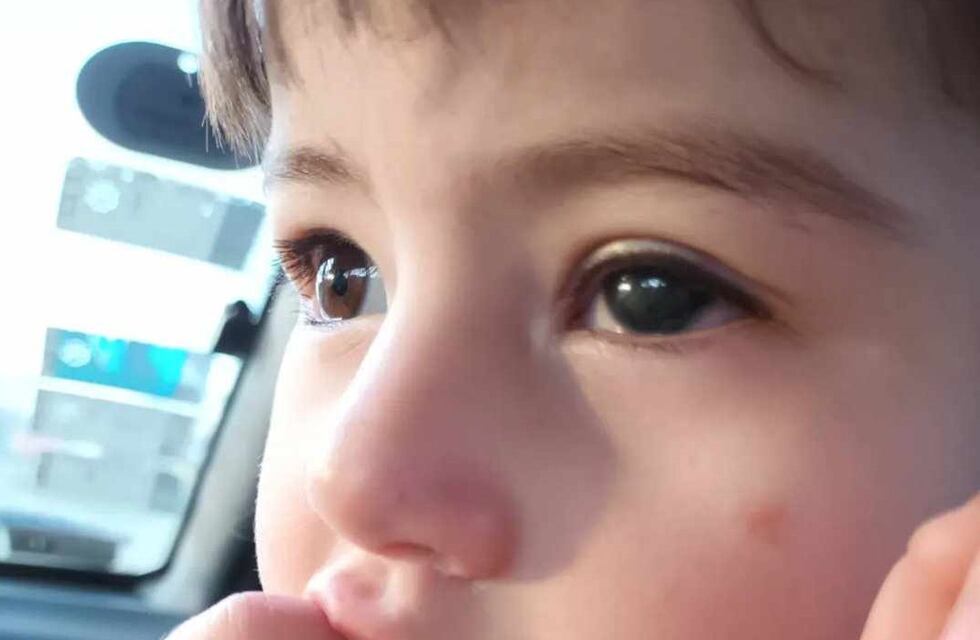 Venden rifas para ayudar a una pequeña puntaltense a viajar al Garrahan