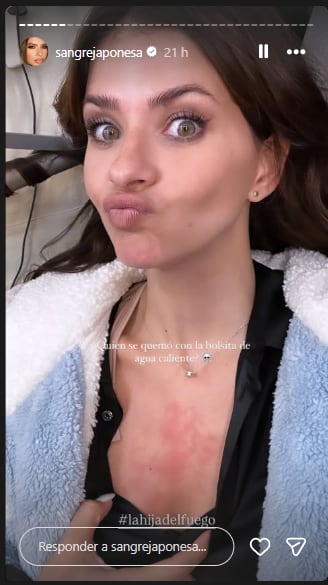 La China Suárez mostró el accidente que tuvo cuando grababa su serie en la Patagonia