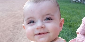 Amelie, la bebé de seis meses que necesita la colaboración de la gente para pagar su tratamiento.