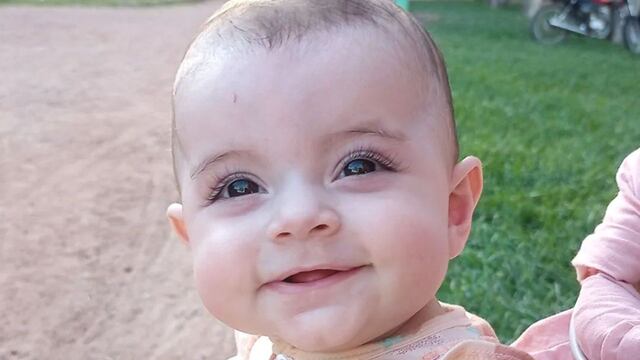 Amelie, la bebé de seis meses que necesita la colaboración de la gente para pagar su tratamiento.