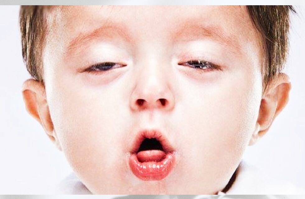 La enfermedad “invisible” de Thiago, un niño de San Luis