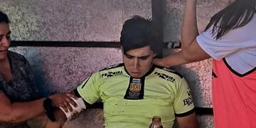 Marcos De Agustino sufrió quemaduras por el impacto de una bengala antes del partido de Fútbol Femenino entre Tiro y San Francisco.