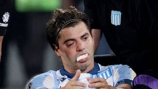 Así quedó Sosa tras el codazo de Rojo (Prensa)