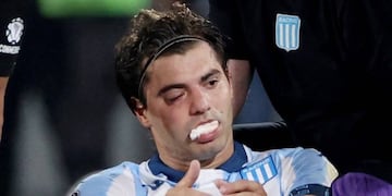 Así quedó Sosa tras el codazo de Rojo (Prensa)