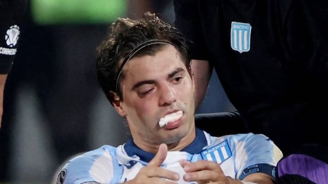 Así quedó Sosa tras el codazo de Rojo (Prensa)