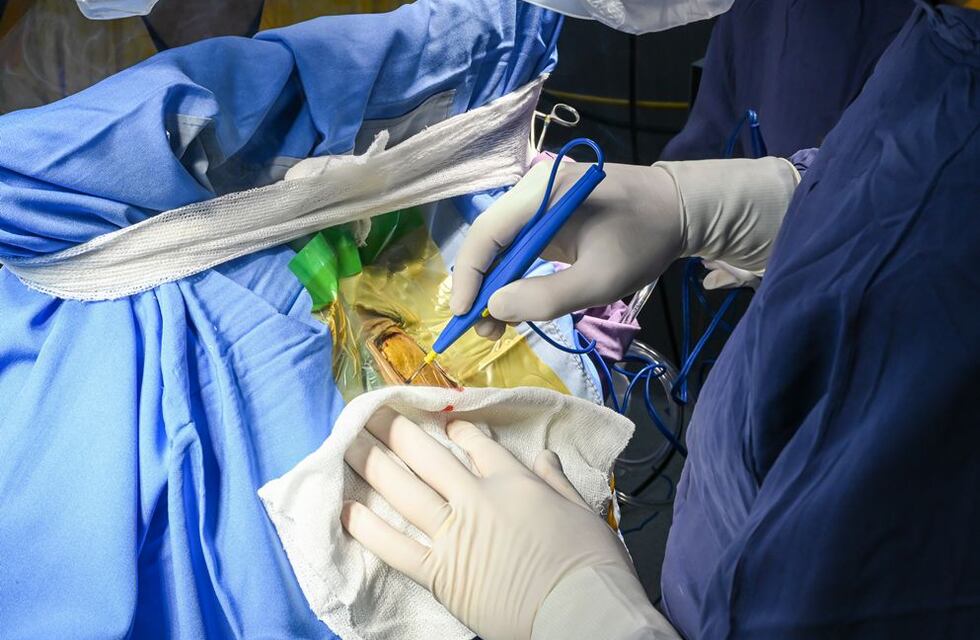 Por primera vez en un hospital público de Córdoba, operaron del cerebro a pacientes despiertos