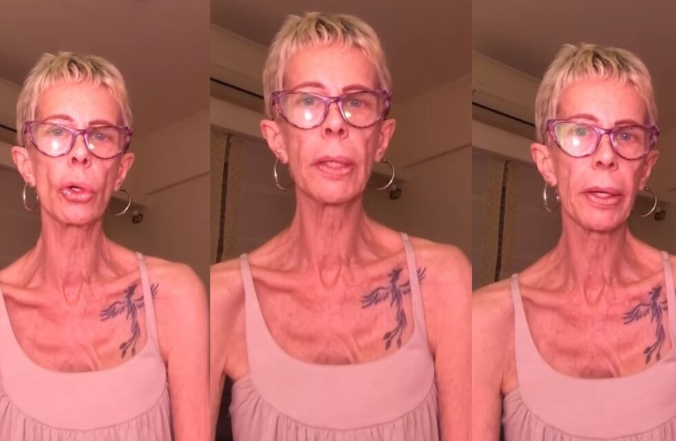 La dramática situación de María Valenzuela: “Peso 35 kilos, no me puedo morir ahora”