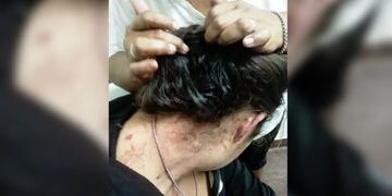 Violencia de género en Posadas terminó con una mujer asistida.