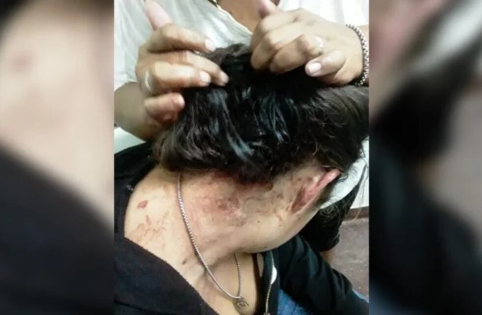 Violencia de género en Posadas terminó con una mujer asistida