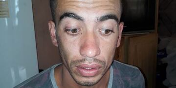 Fue detenido cerca del mediodía en barrio San Roque, acusado de un robo calificado.