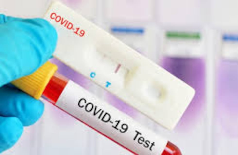 Este jueves se registró el mayor número de contagios en Misiones desde el inicio de la pandemia