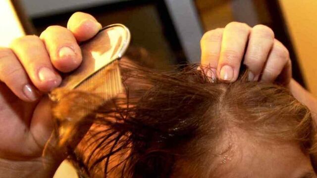 Una cordobesa se ofrece a “sacar piojos” para poder llegar a fin de mes