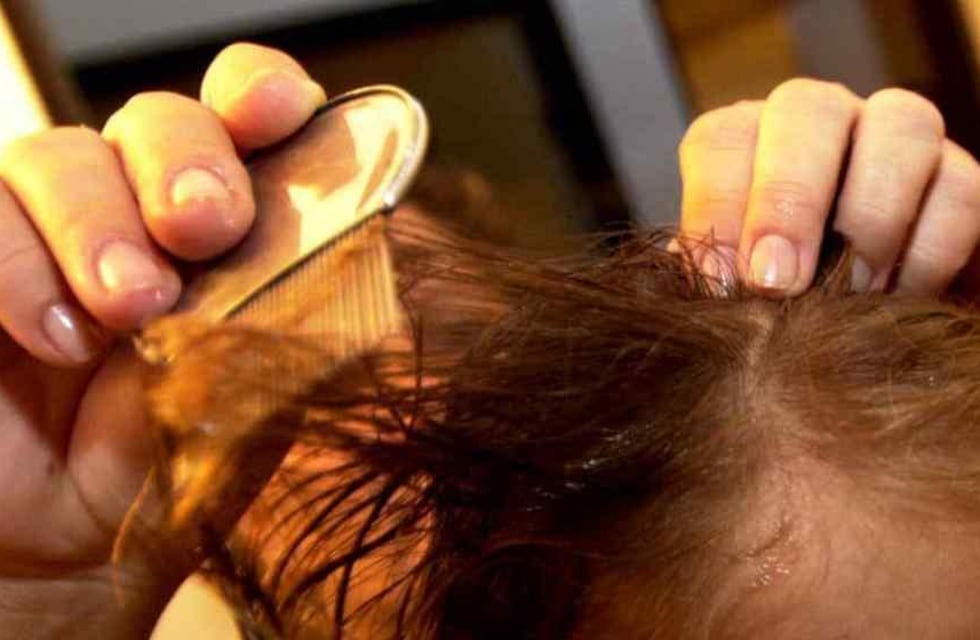 Una cordobesa se ofrece a “sacar piojos” para poder llegar a fin de mes