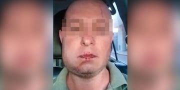 Carlos Galíndez fue brutalmente golpeado por policías de Río Cuarto