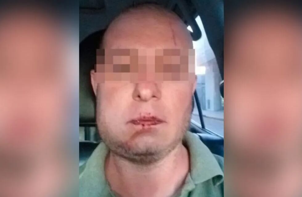 Violencia policial: uno de los efectivos tiene antecedentes por golpes a un menor