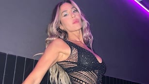 Jimena Barón enfrentó las críticas y reveló cuáles son las cirugías estéticas que se hizo