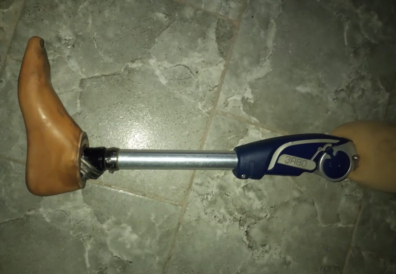 Martín pide ayudar para encontrar su prótesis. (Foto: El Doce)