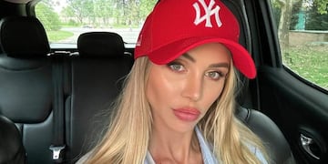 Romina Malaspina reveló el problema que sufre en los labios tras una intervención estética