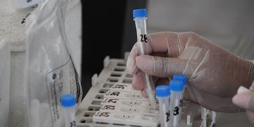 Muestras de hisopados para detectar el Covid-19 en el Centro Cultural Julio Le Parc de Guaymallen.
Foto: Jose Gutierrez