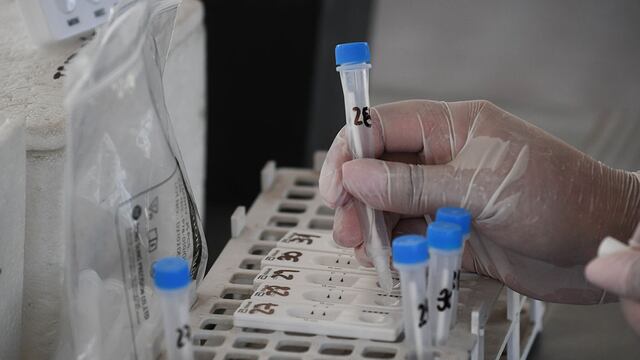 Muestras de hisopados para detectar el Covid-19 en el Centro Cultural Julio Le Parc de Guaymallen.
Foto: Jose Gutierrez