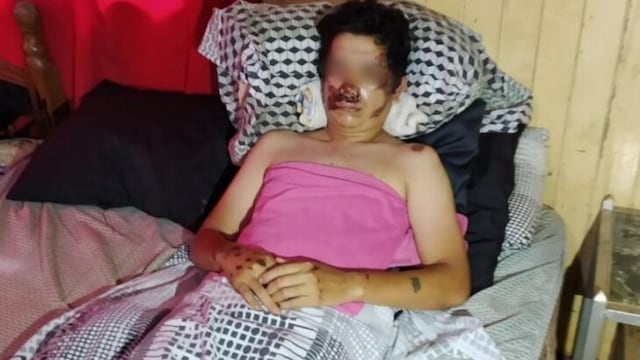Eldorado: dijo que fue asaltado pero luego admitió que se cayó de la moto borracho