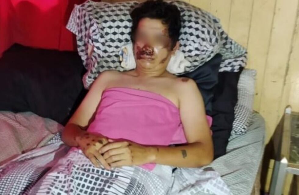 Eldorado: dijo que fue asaltado pero luego admitió que se cayó de la moto borracho