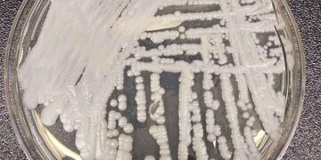 Cepa de candida auris cultivada en un laboratorio. Ya hay dos casos en Argentina.