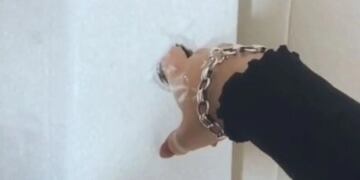 Bizarro e insólito: así le quedó el dedo atorado en el botón del baño.