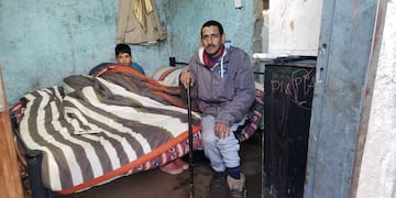 Rubén quedó viudo hace dos meses y está impedido de trabajar a causa de una herida, complicada por la diabetes.