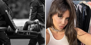 La dura lesión de Mauro Icardi que compromete su futuro con Wanda Nara