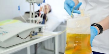 El tratamiento con plasma se realiza al inicio de los síntomas en pacientes moderados. Diario de Cuyo