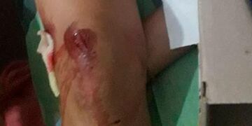 A la joven intentaron secuestrarla y logró arrojarse del vehículo en movimiento. Terminó con múltiples golpes (Gentileza).