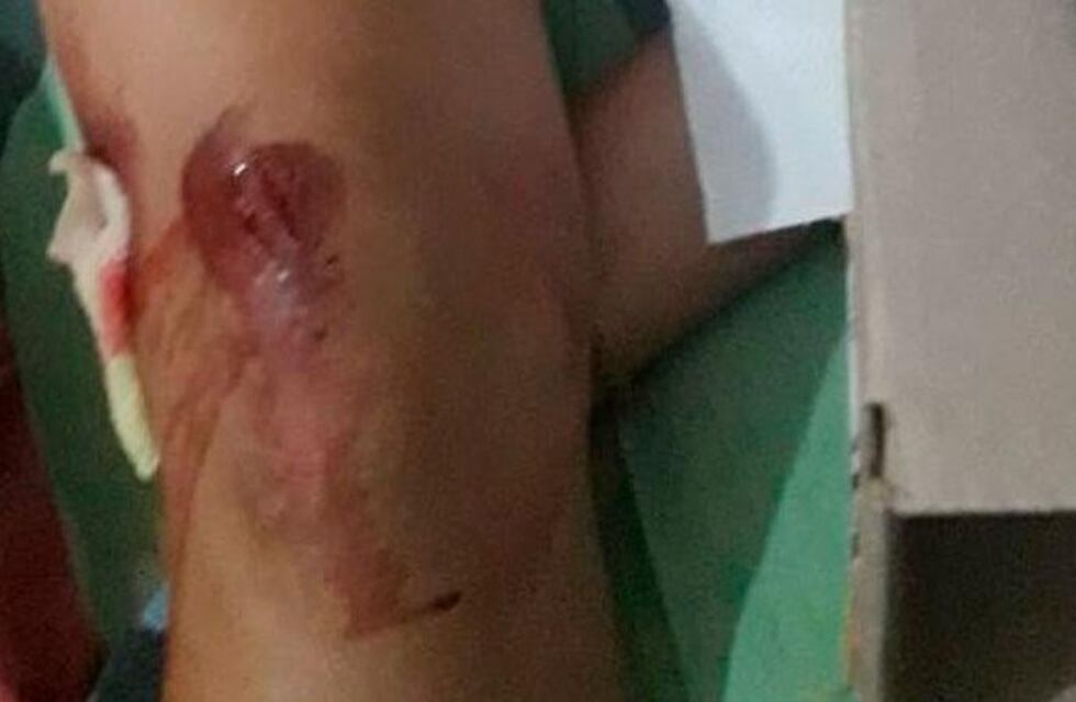 Córdoba insegura: intentaron secuestrar a una adolescente, y escapó tirándose del auto