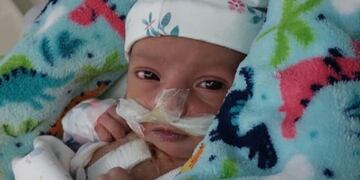 Tuvieron que abandonar su vida en Mendoza para salvar la de su hija, la historia de Lúa y la lucha de sus padres