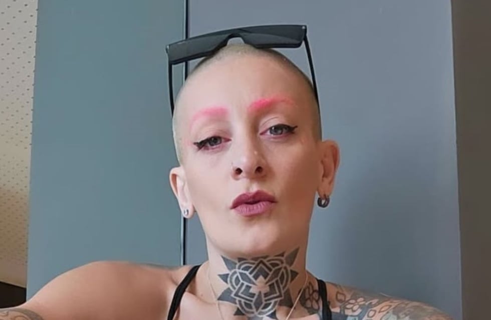 ¡Irreconocible! Así quedó Furia de Gran Hermano tras realizarse otro retoque estético: el impactante antes y después