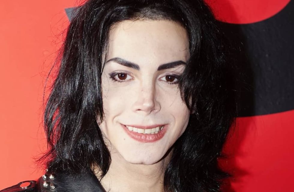 Es el imitador argentino de Michael Jackson, lo confundieron con Felipe Pettinato y lo golpearon