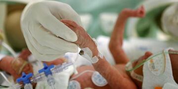 El Hospital Dr. Jaime Ferré conmemorará el Día Mundial del Prematuro con una jornada para toda la familia